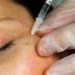 FDA warns websites selling unapproved Botox for cosmetic purposes